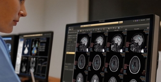 Philips IntelliSpace Portal for Education purpose